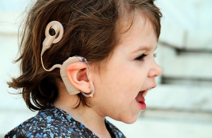 Cochlear Implant: Yay or Nay